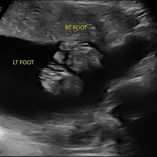 Not So Serious Podcast